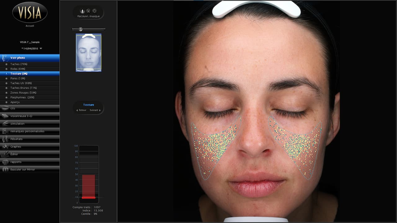 Vue de l'écran d'analyse de la texture de peau du diagnostic de visage du Visia 7 au sein d'Anthèse Bordeaux
