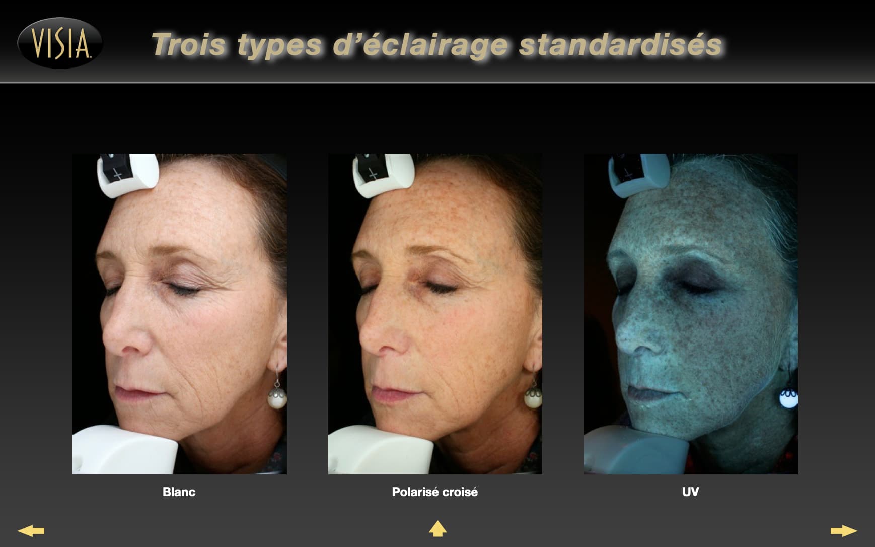 Ecran de controle du Visia 7 permettant un diagnostic de peau intelligent utilisé au sein d'Anthèse Bordeaux - étape 1