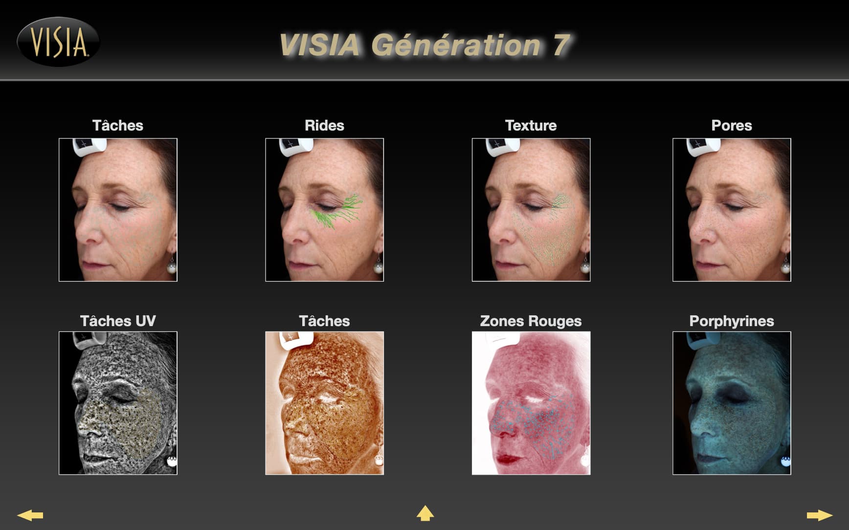 Ecran de controle du Visia 7 permettant un diagnostic de peau intelligent utilisé au sein d'Anthèse Bordeaux - étape 3