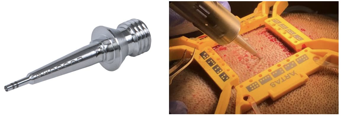 artas-ix-ultra-punch ARTAS® iX Ultra Punch produit des greffons robustes pour l’implantation.